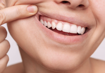 chirurgiens dentistes lezignan orthodontieDrs BLUCHE & MONTANARO | Dentistes Lézignan-Corbières