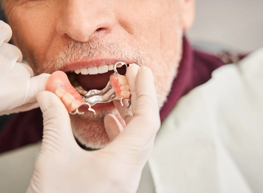 instabilite protheses dentaires instabilite protheses dentairesInstabilité des prothèses dentairesDrs BLUCHE & MONTANARO | Dentistes Lézignan-Corbières