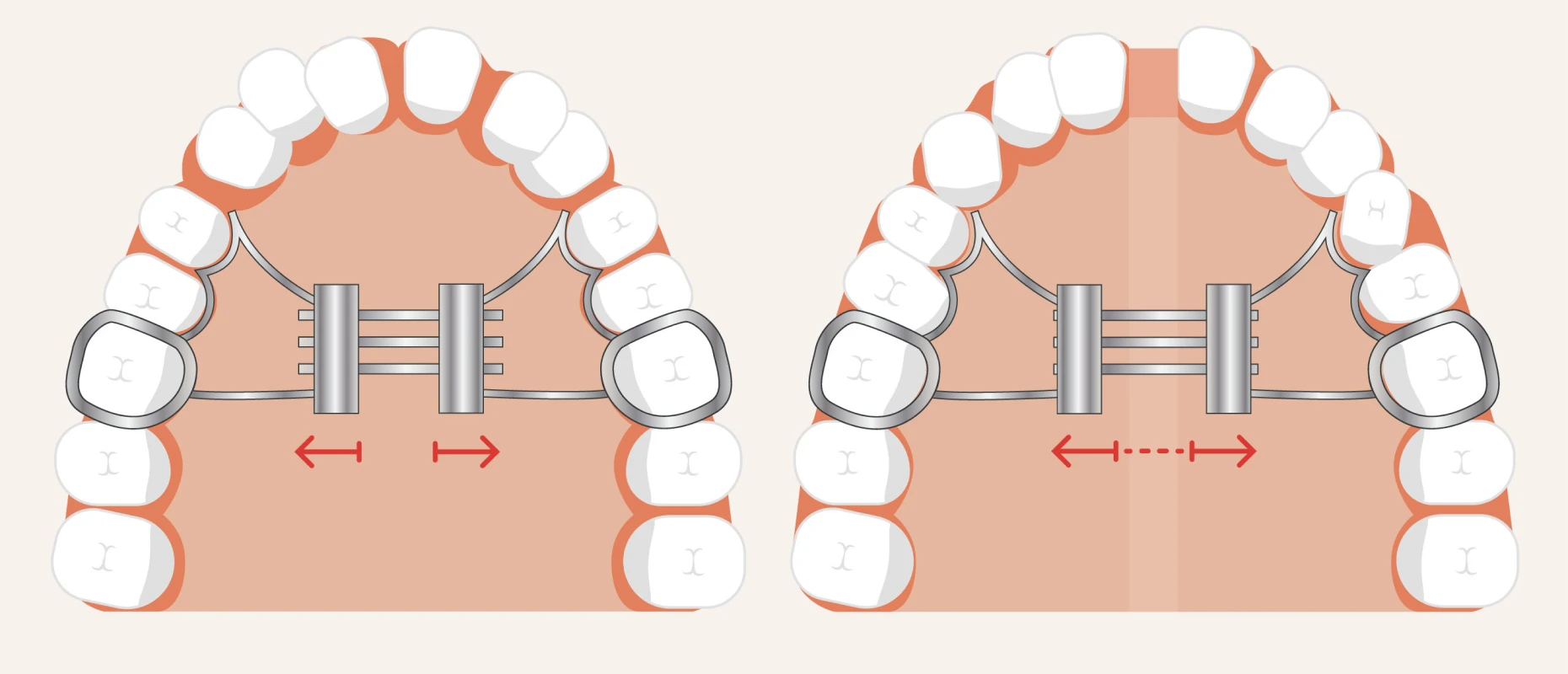 disjoncteur docteur montanaro disjoncteur docteur montanaroDisjoncteurDrs BLUCHE & MONTANARO | Dentistes Lézignan-Corbières