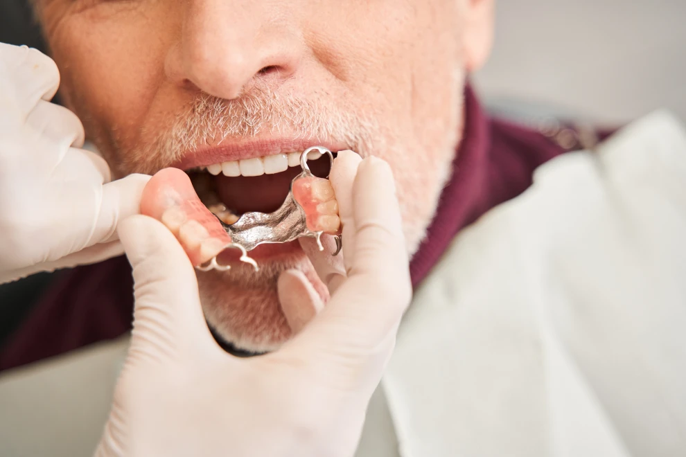 prothese amovible lezignan corbieres prothese amovible lezignan corbieresProthèses amoviblesDrs BLUCHE & MONTANARO | Dentistes Lézignan-Corbières