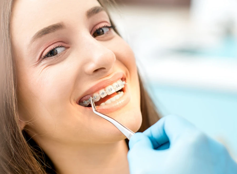 multi bagues metal adolescen drs montanarots multi bagues metal adolescen drs montanarotsTraitement par multi-baguesDrs BLUCHE & MONTANARO | Dentistes Lézignan-Corbières